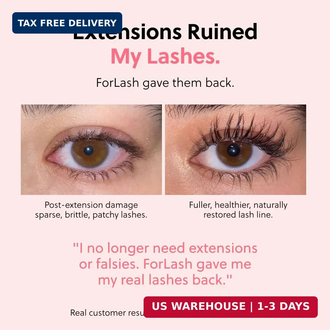 ForChics Eyelash Growth Serum – Prostaglandin-Free Lash Enhancing Serum for Long
