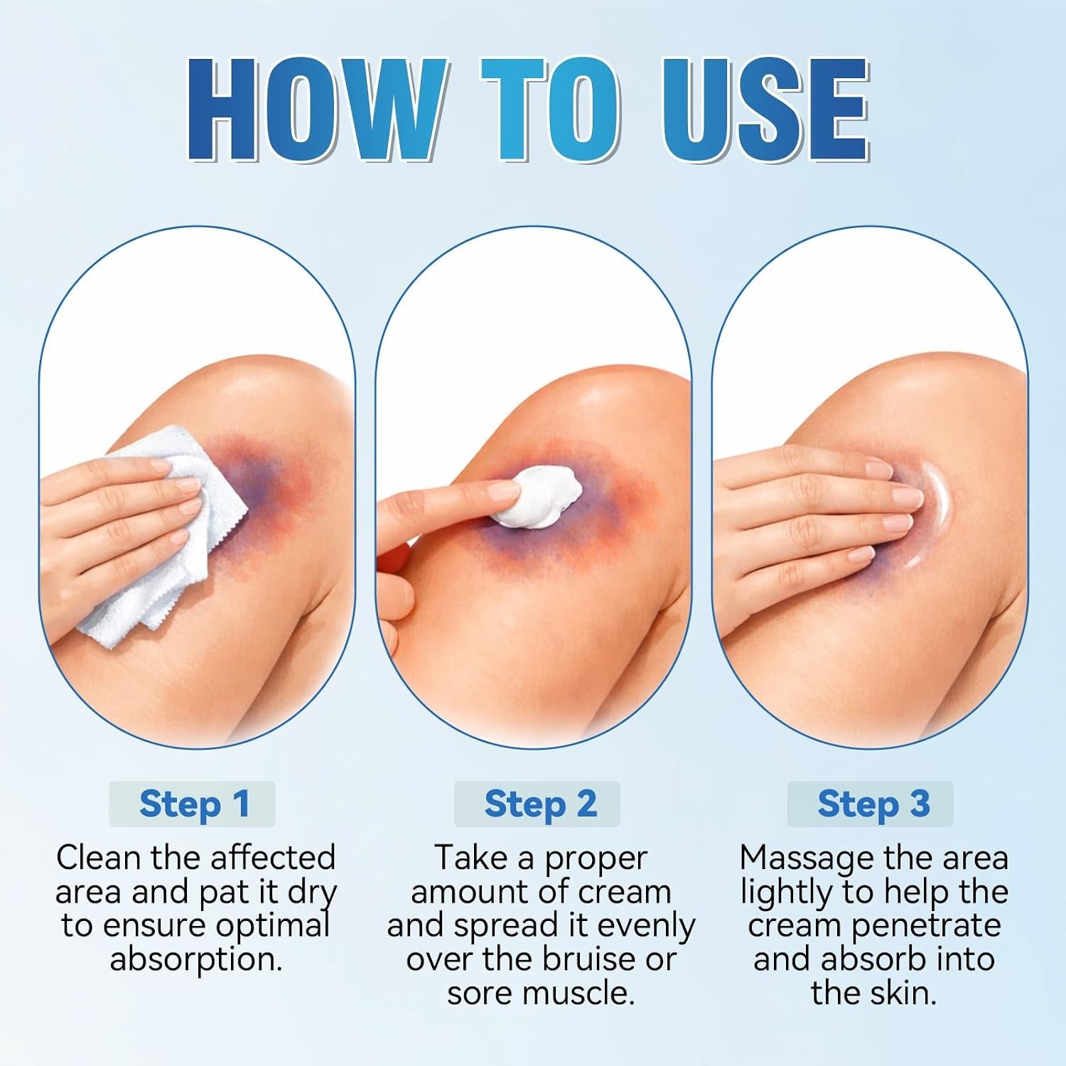 Arnica Bruise Repair Cream with Vitamin K C E Skin Renewal for Seniors Thin Skin