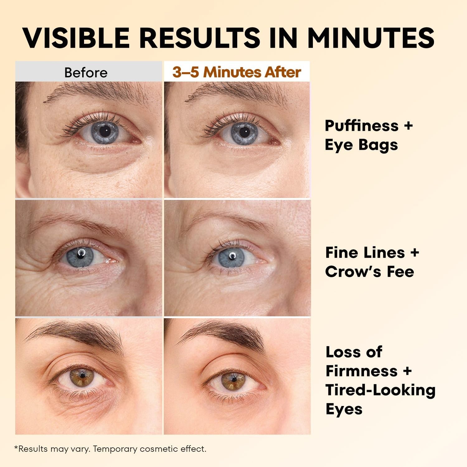 Instant Eye Firm Tightener – Fast-Acting Under-Eye Solution for a Youthful Look
