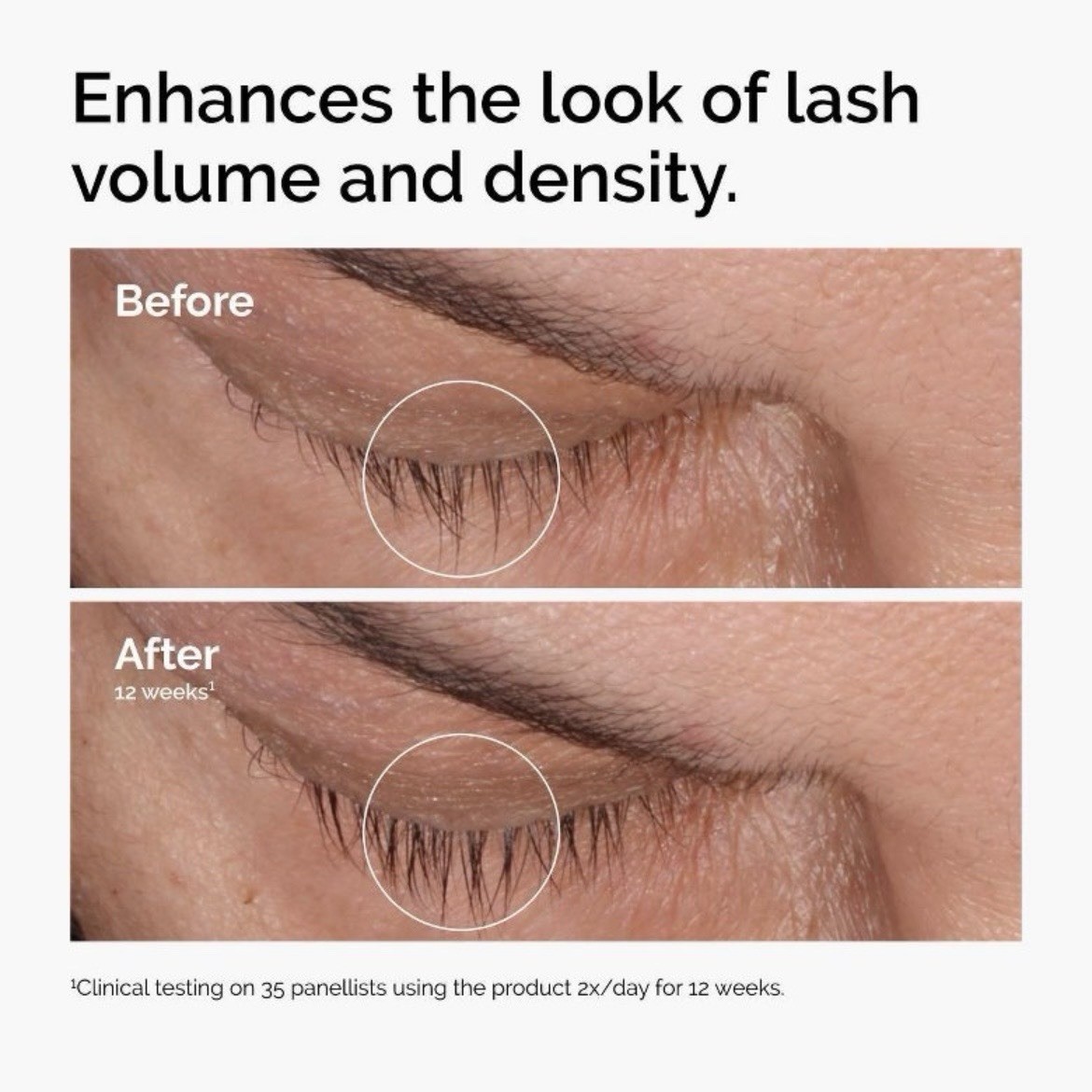 The Ordinary Multi-Peptide Lash & Brow Serum – Prostaglandin-Free 0.16 fl oz 🔥