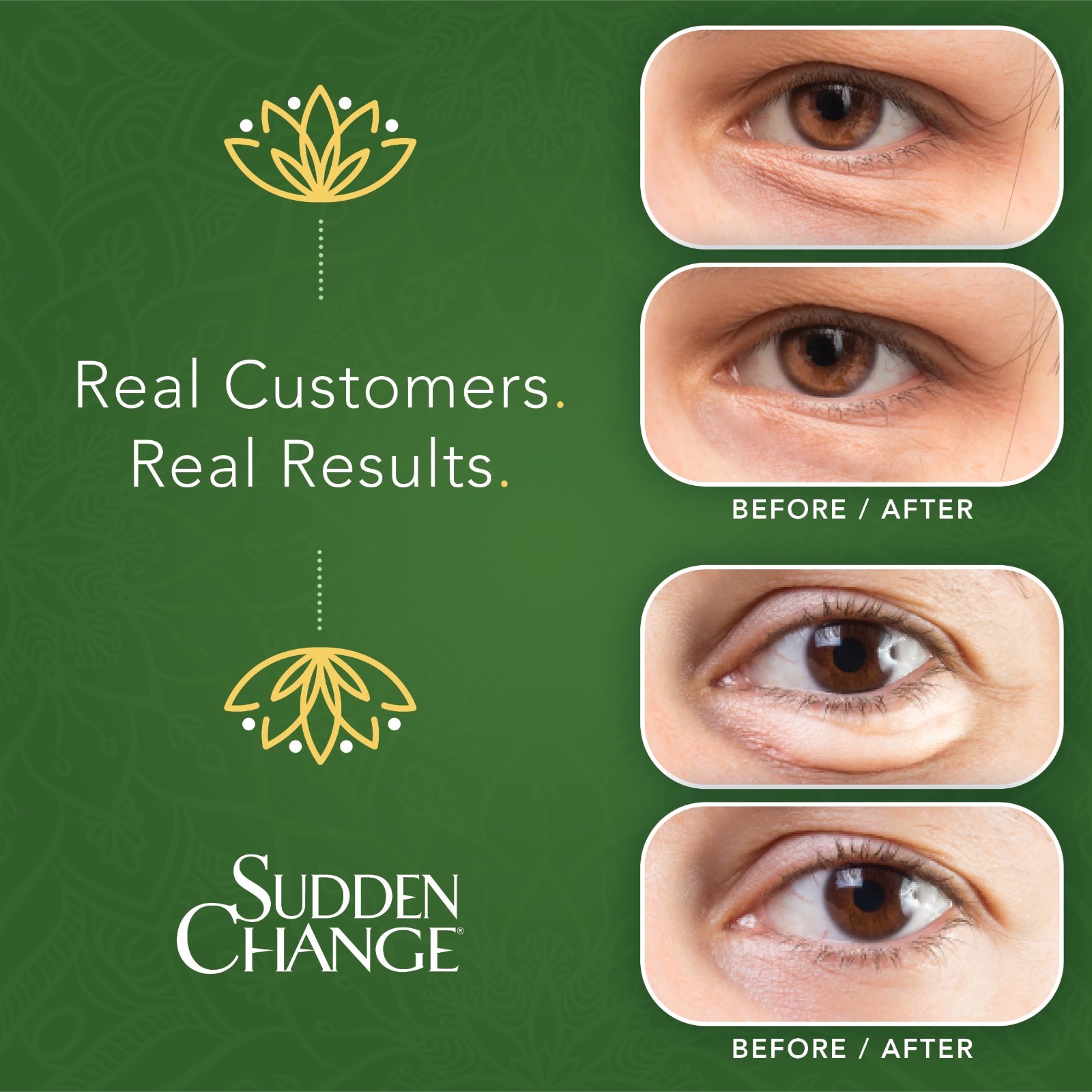 Sudden Change Instant Eye Tightening Serum for Under Eye Appearance – FREE SHIP
