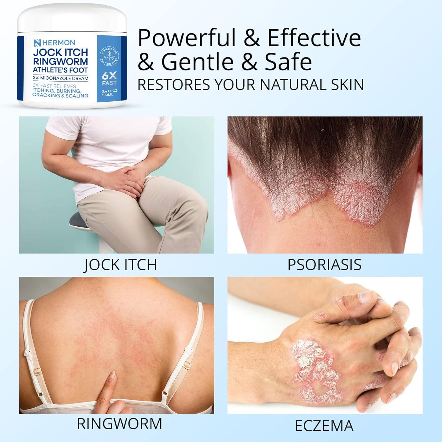 Jock Itch Antifungal Cream, Psoriasis Cream, Ringworm Treatment for Humans, 2026