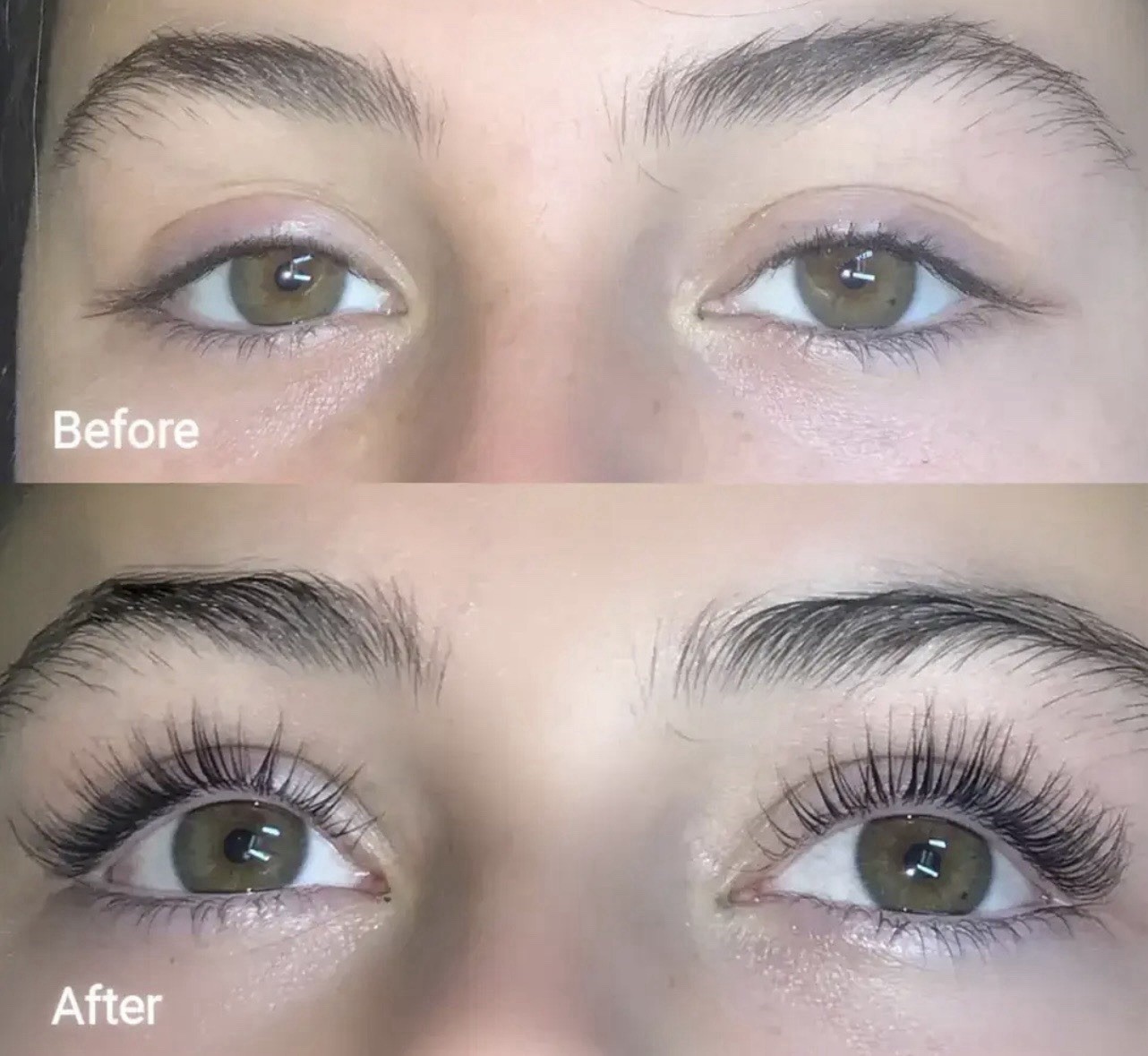 Forchics Eyelash Growth Serum – Prostaglandin-Free Lash Enhancing Serum for Long