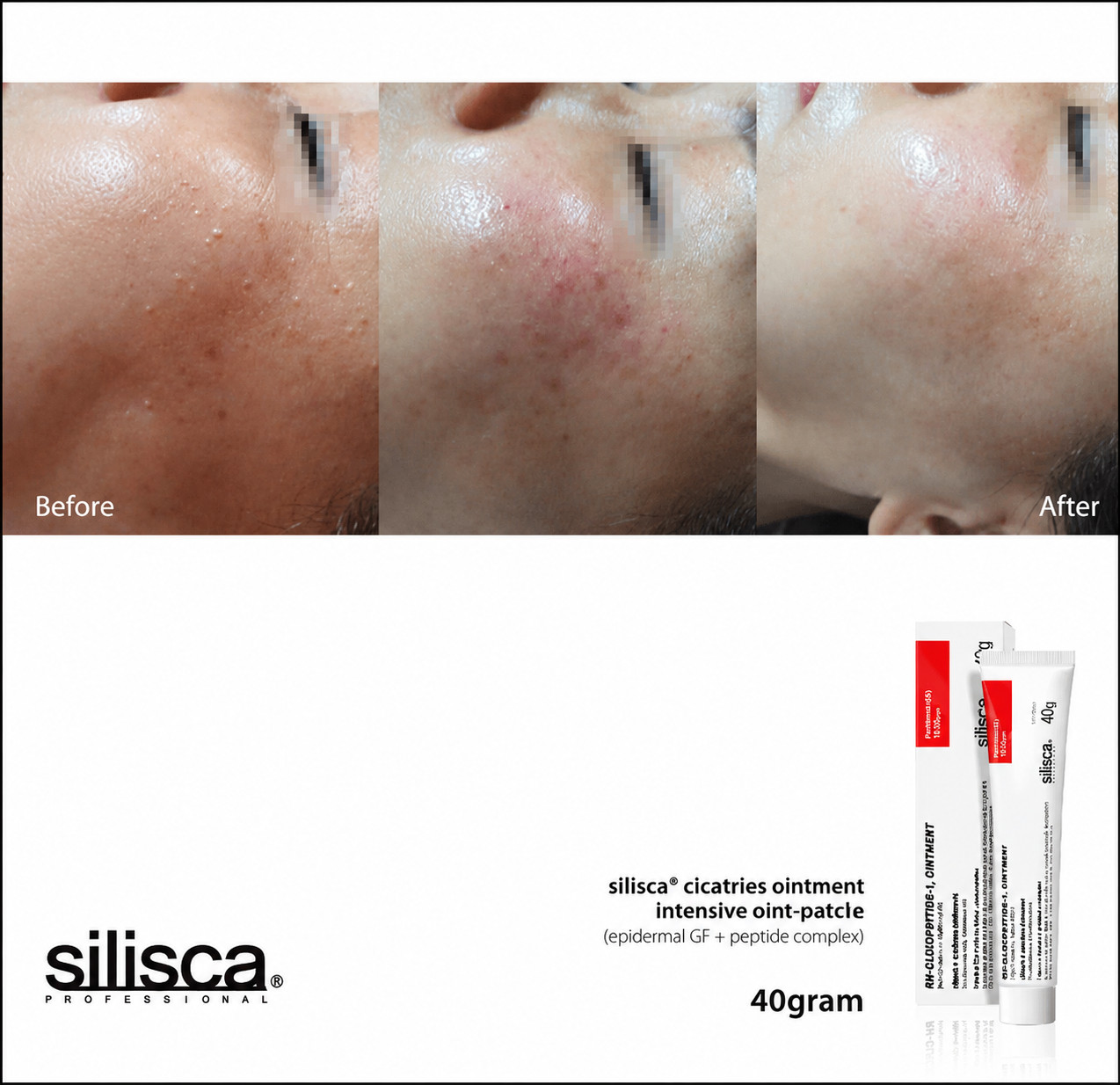 Silisca Cicatries Ointment 40g Intensive Skin Recovery Cream+FREE SAMPLES