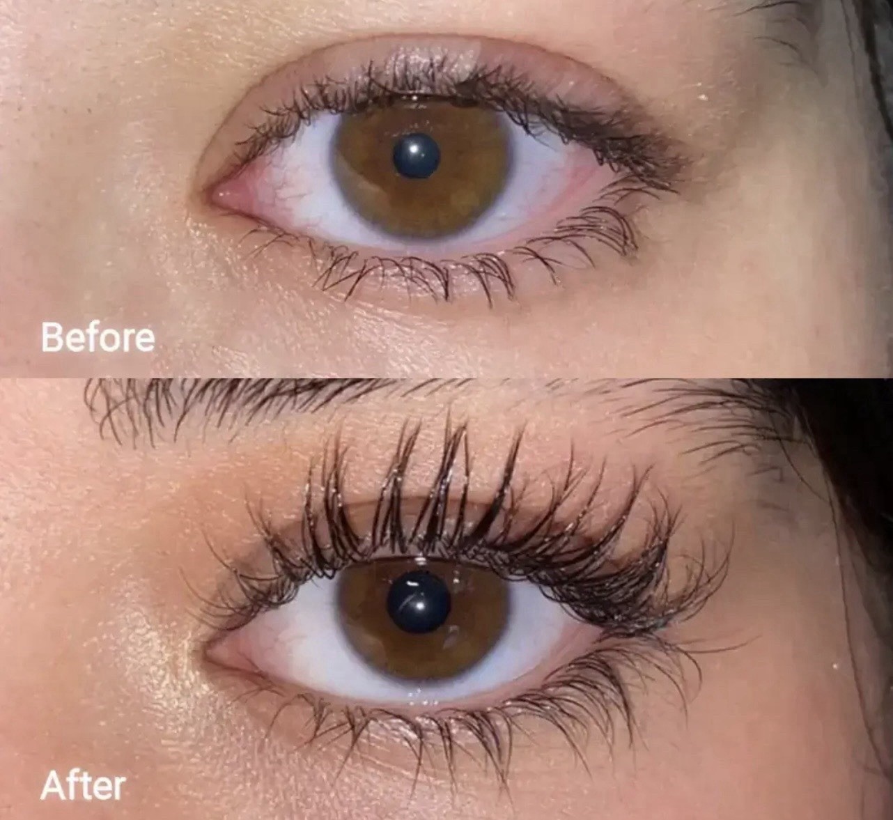 Forchics Eyelash Growth Serum – Prostaglandin-Free Lash Enhancing Serum for Long
