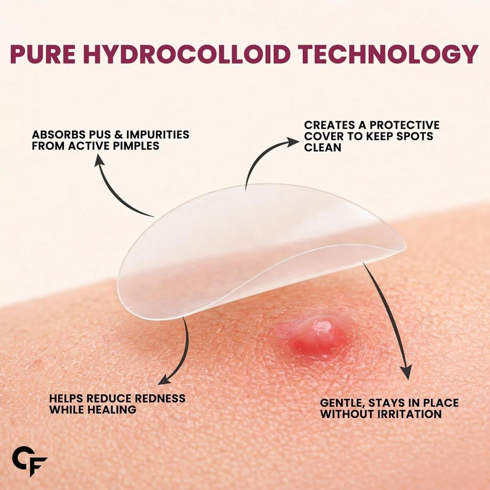 Carbamide Forte for Face Salicylic Acid & Cica 72 Hydrocolloid Pimple Patches