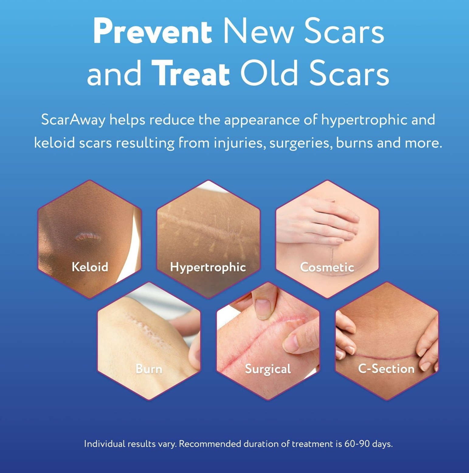 ScarAway Silicone Scar Gel 0.35oz Medical Grade Advanced Skincare Treatment