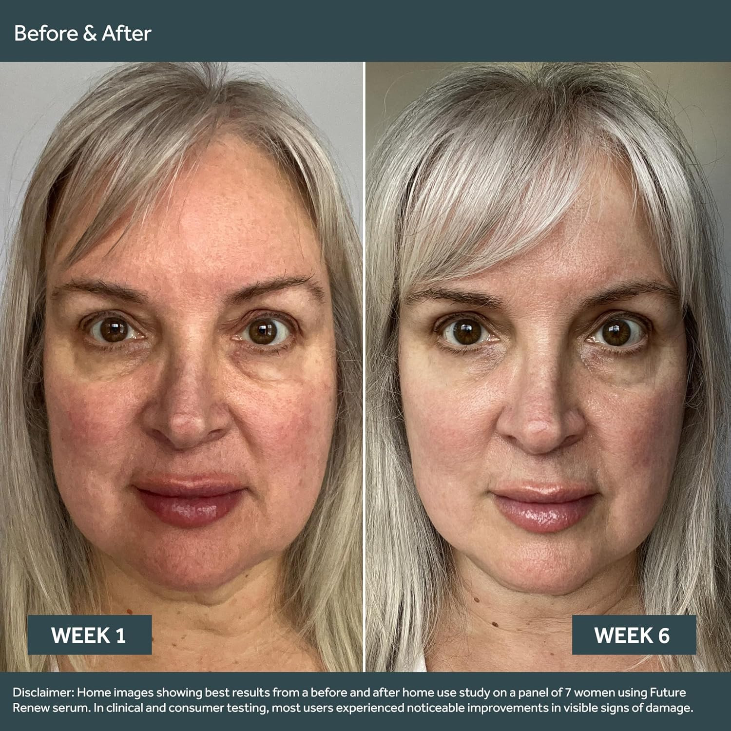 Future Renew Damage Reversal Face Serum – Anti-Aging Serum for Glowing Skin – Hy