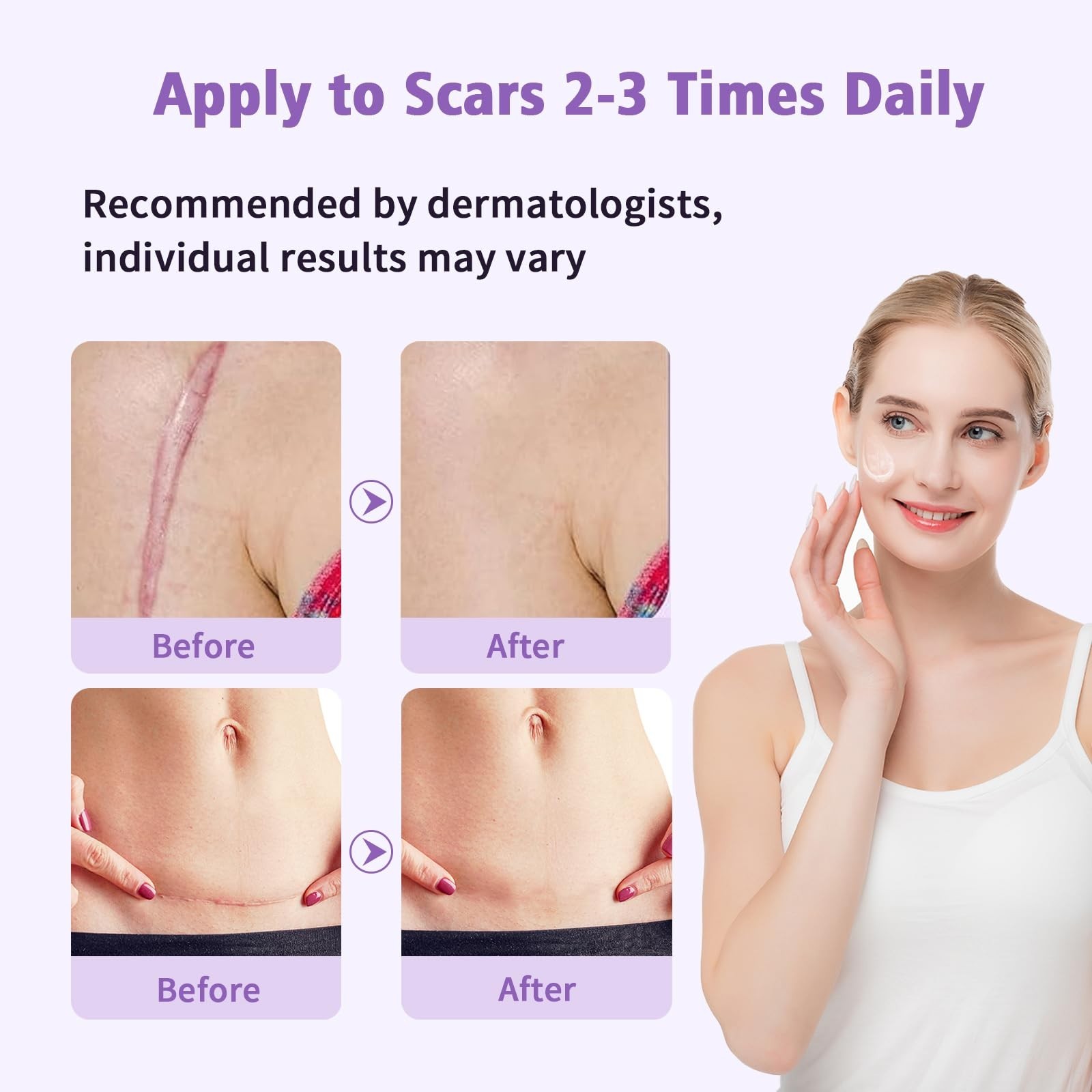 Medical Grade Silicone Scar Gel for Surgical & Acne Scars, 1.7oz – Fast Healing
