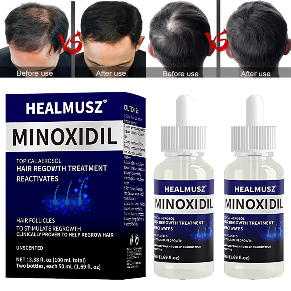 Minoxidil 5% Hair Regrowth Solution Extra Strength Men Women 2-10 Months Supply