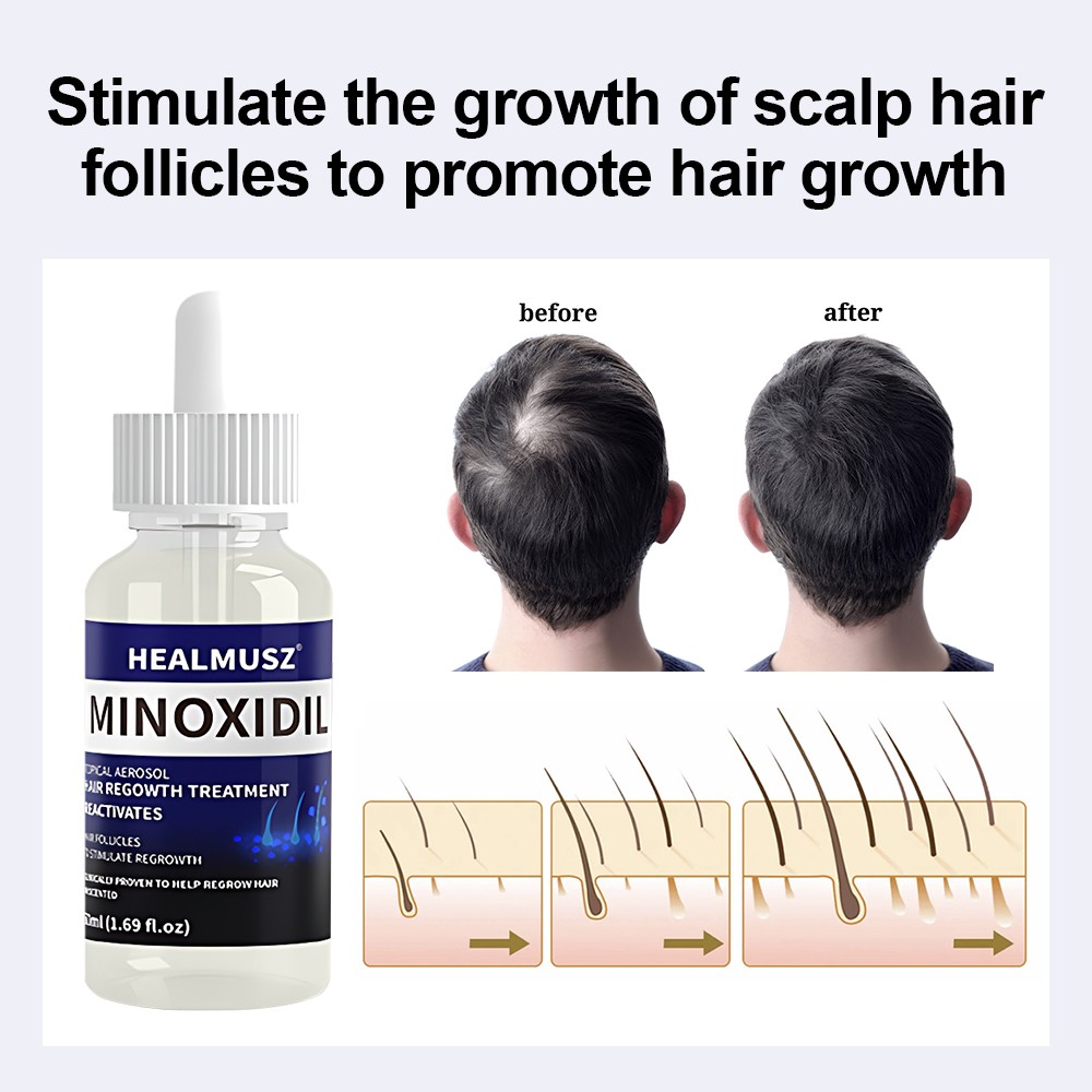 HEALMUS Minoxidil 5% Extra Strength Men 2-10 Month Supply Hair Regrowth Solution