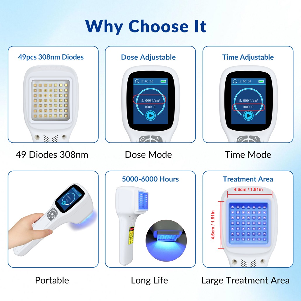 Handheld 308nm UVB Light Phototherapy Device Portable for Eczema Skin Therapy