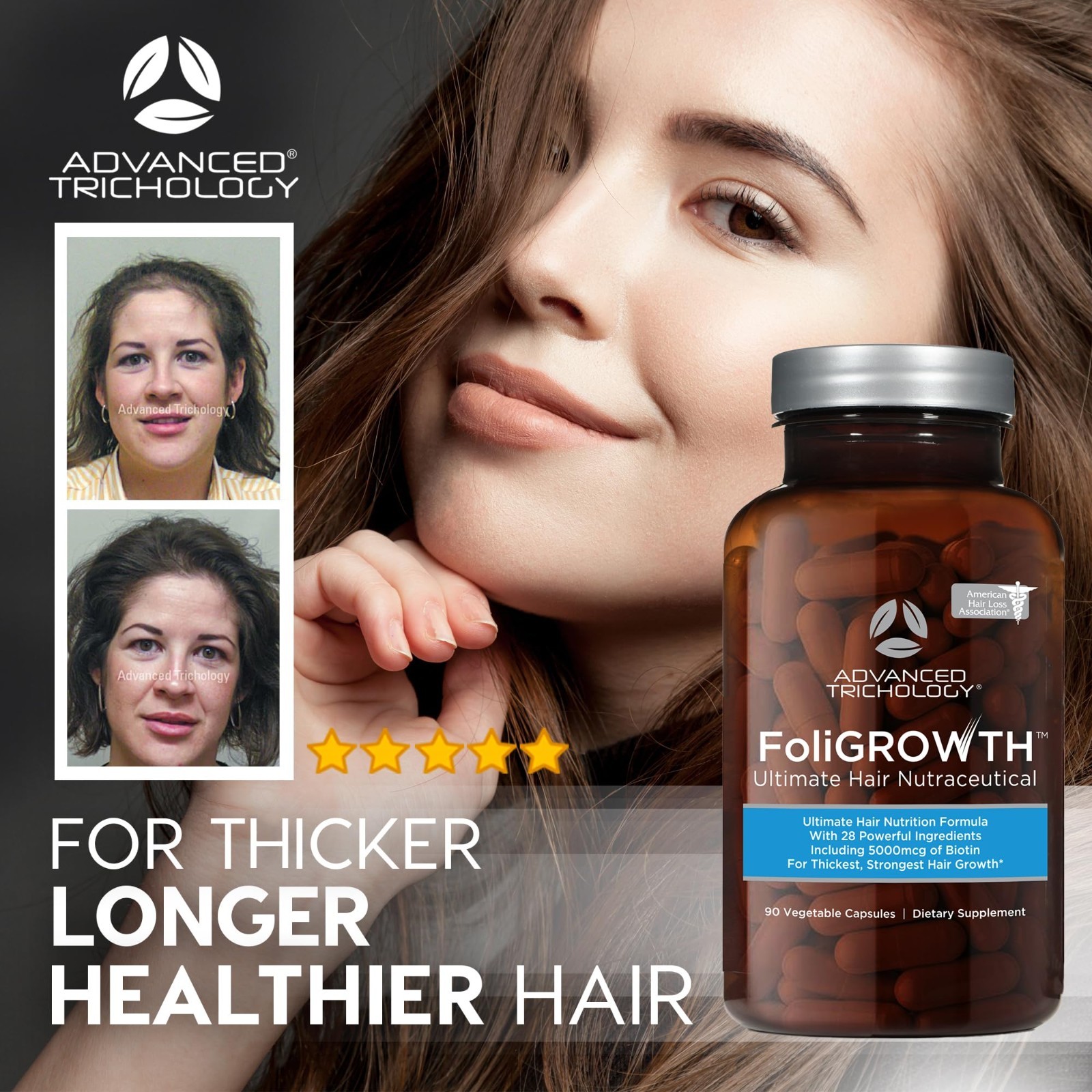 FoliGROWTH Hair Growth Supplement for Thicker Fuller Hair