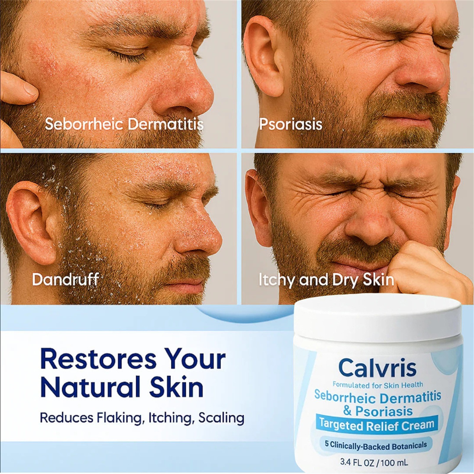Calvris Seborrheic Dermatitis & Psoriasis Treatment Cream Beard Recovery Cream
