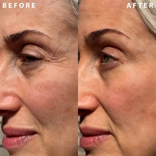 IL MAKIAGE Power Redo Anti Aging Wrinkle Filler 20ml – Blur Smooth Fine Lines Po