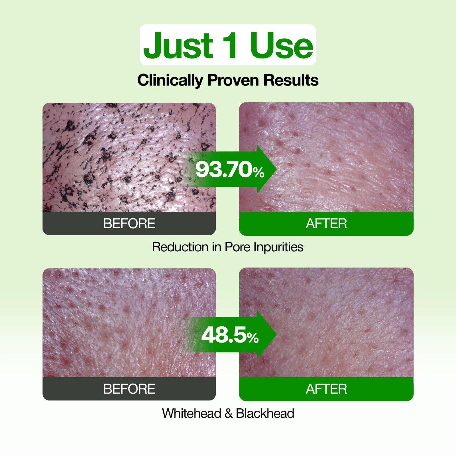 Deep Pore Cleanser Clay Mask, Green Tomato Face Wash for Blackhead Control, Kore