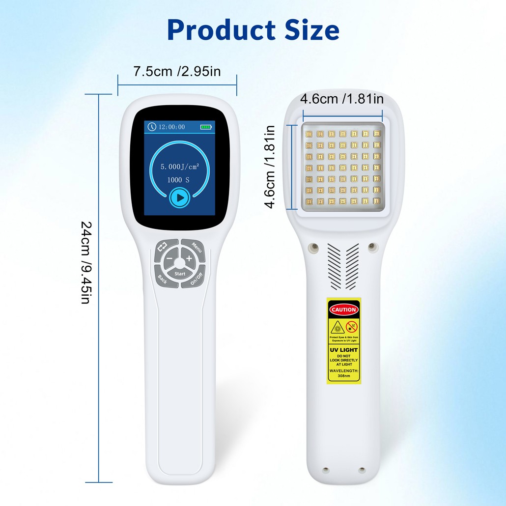 Handheld 308nm UVB Light Phototherapy Device Portable for Eczema Skin Therapy