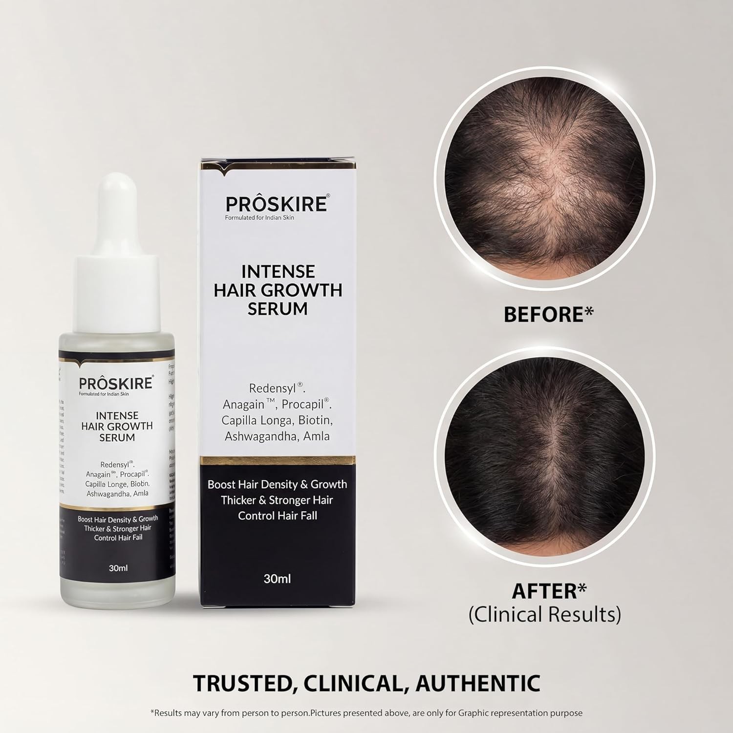 Proskire Intense Hair Growth Serum With Redensyl, 30ML each pack of 3
