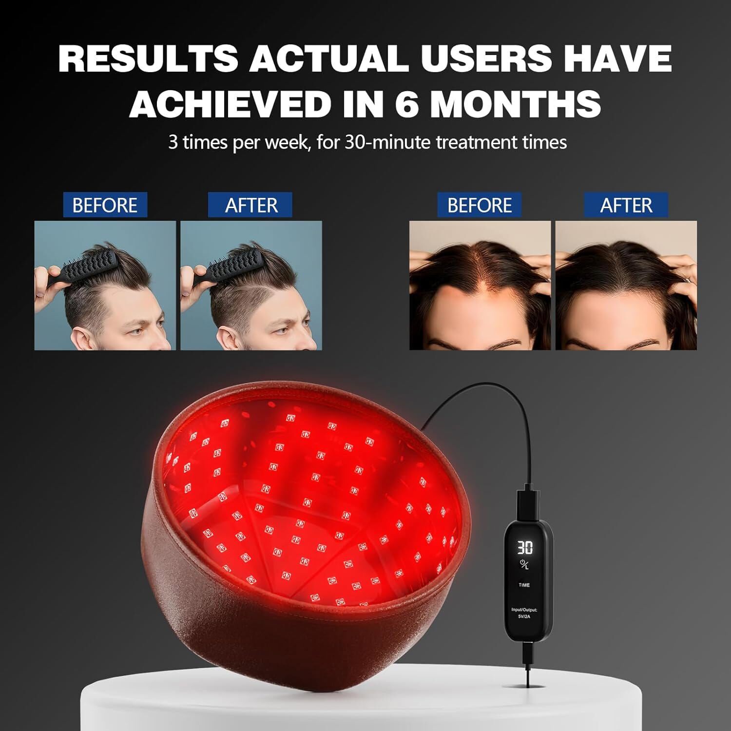 660Nm Red Light Therapy Cap Laser Hair Growth Hat Loss Alopecia Treatment HOME
