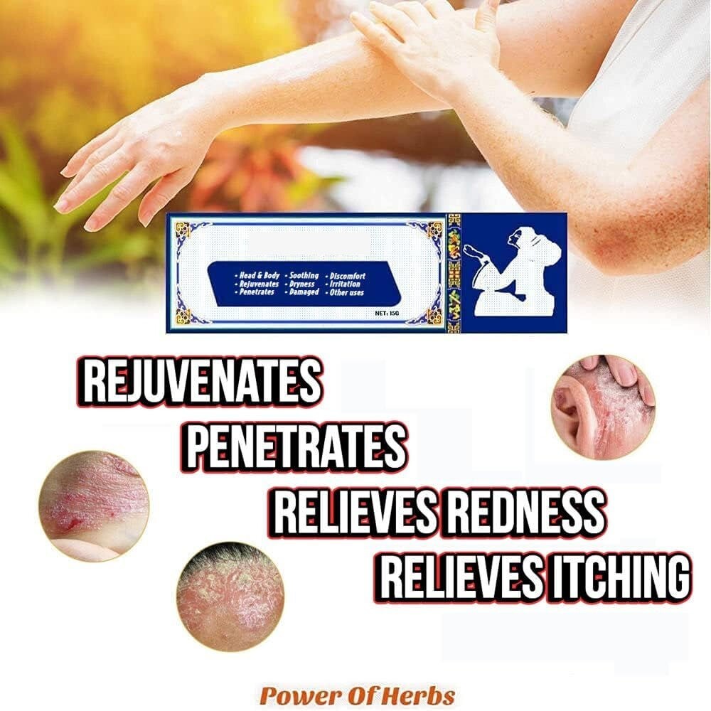 SKIN OINTMENT BODY PSORIASIS DERMATITIS ECZEMA NATURAL TREATMENT CREAM 15G