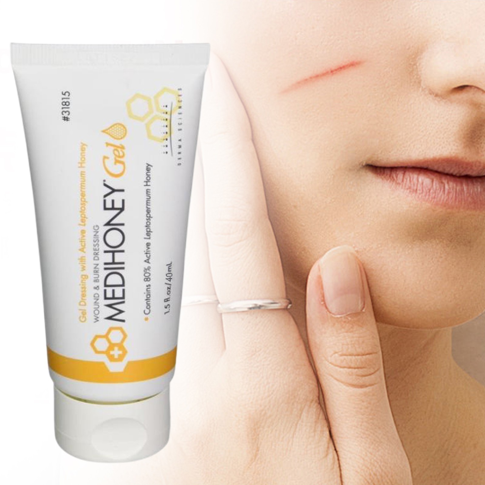 1-3Pack-Medihoney Gel Wound and Burn Dressing from Derma Sciences 1.5 oz New