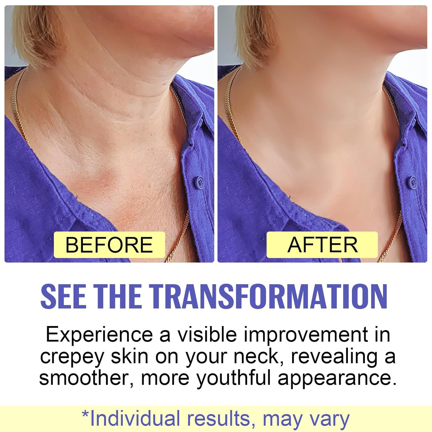 Neck Firming Cream – anti Aging Neck Tightening Cream for Sagging Skin, 1.7 Fl O